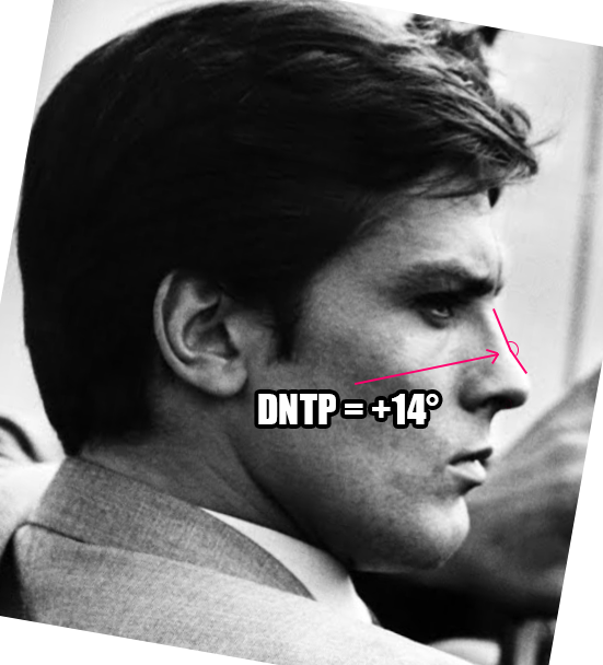 Nose