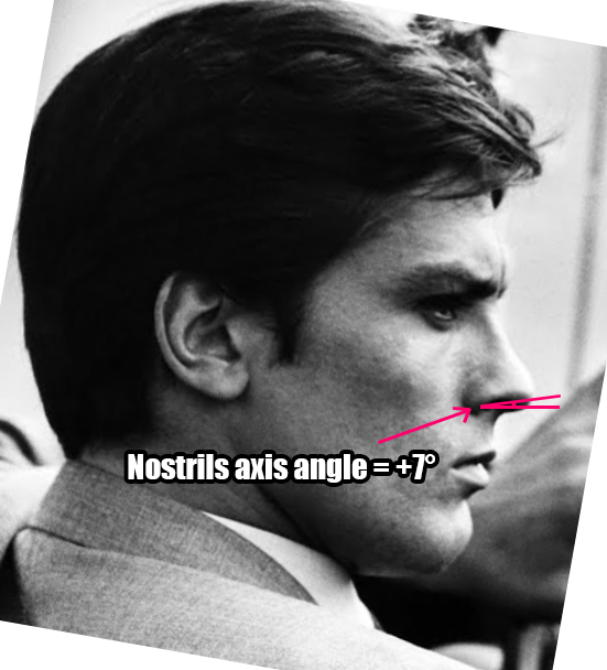 Nose