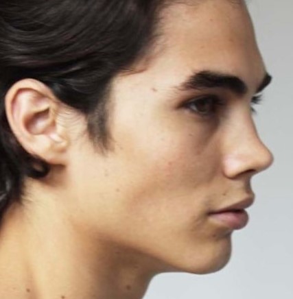 Nose