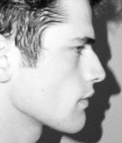 Nose