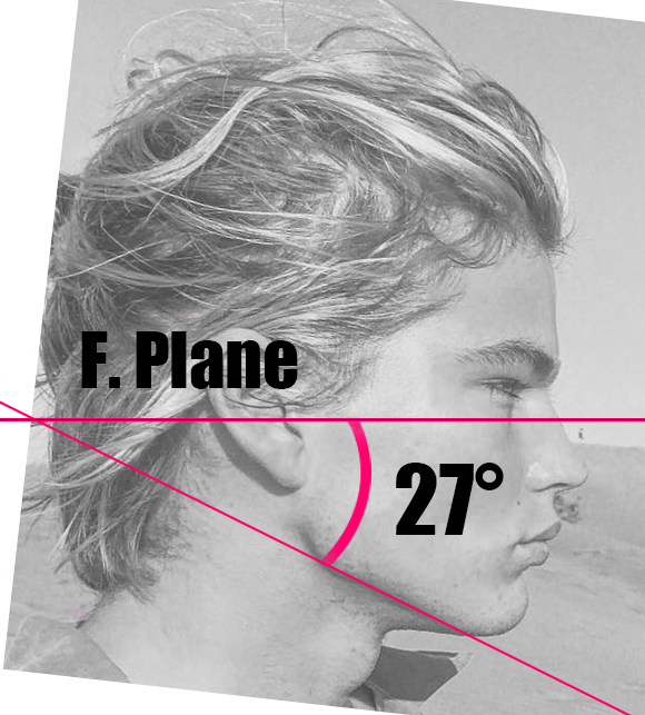 Ratios